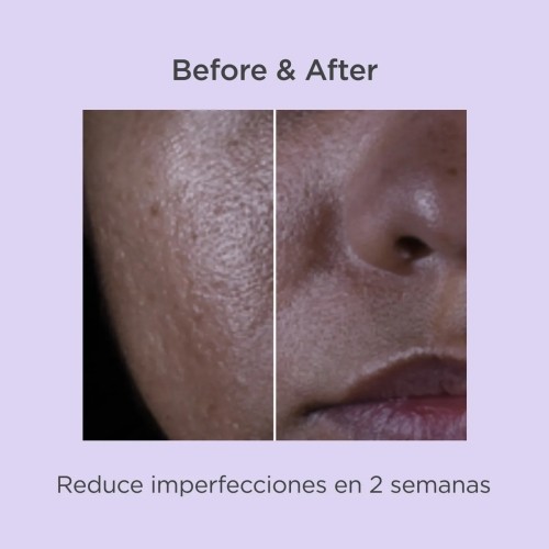 Isdin Salicylic Renewal...
